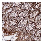 Atlas Antibodies Anti-PKIG Antibody
