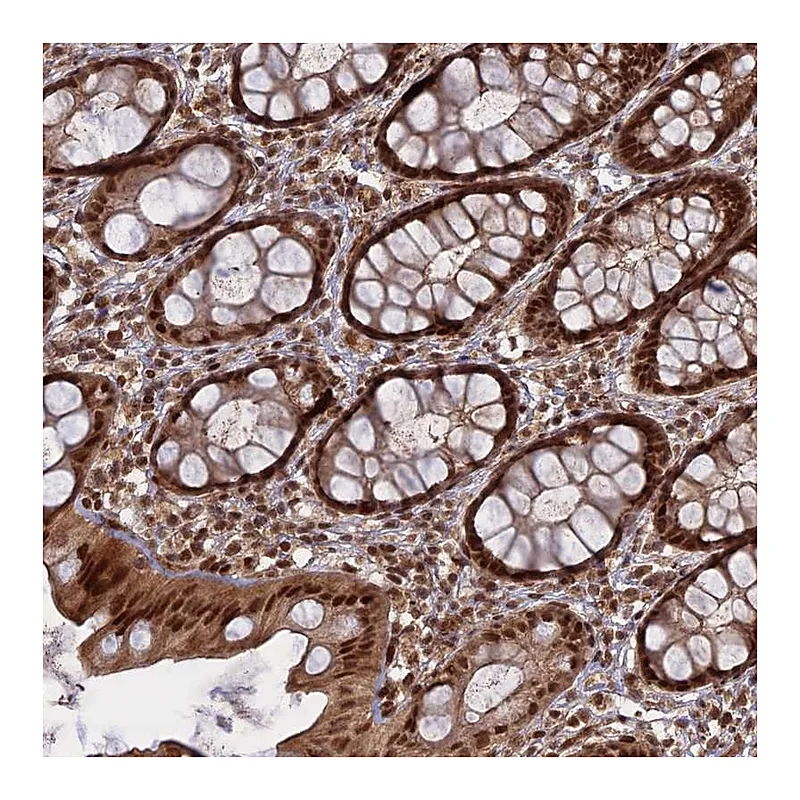 Atlas Antibodies Anti-PKIG Antibody