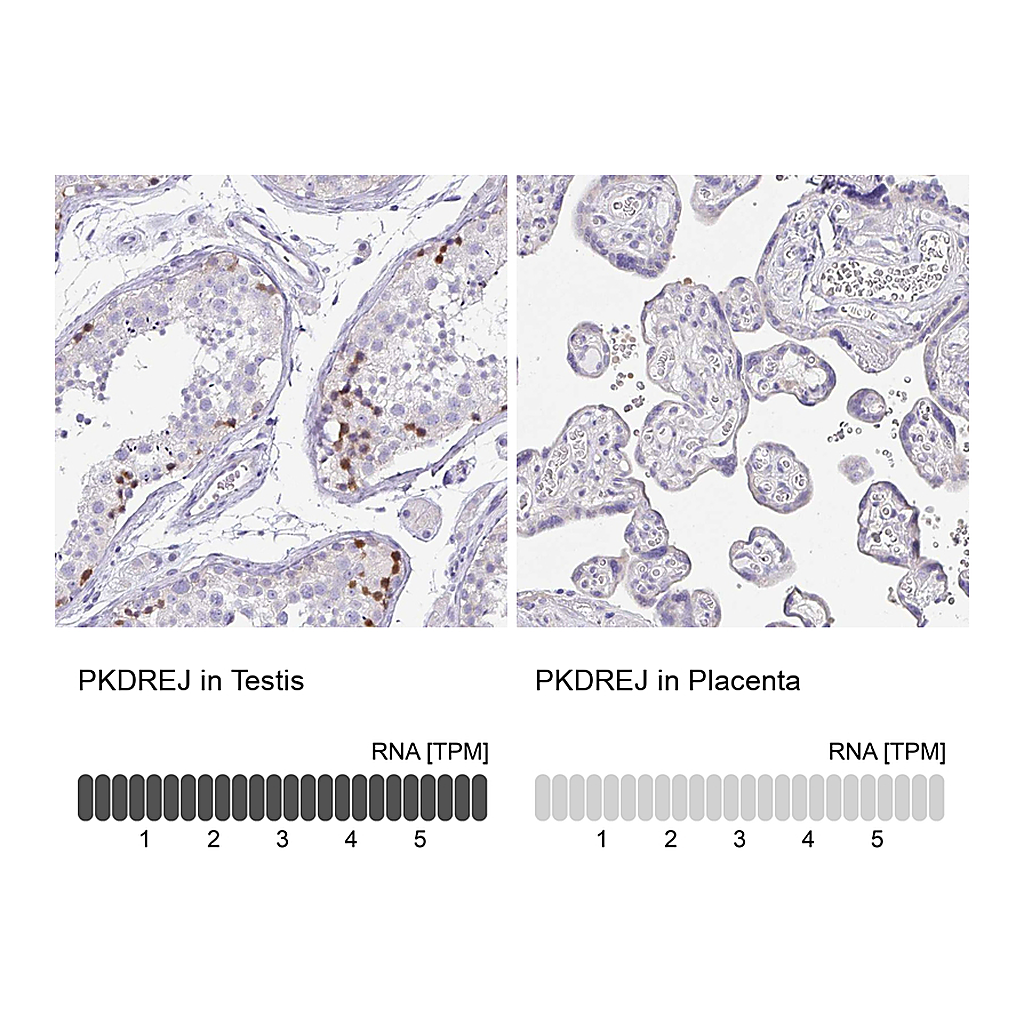 Atlas Antibodies Anti-PKDREJ Antibody