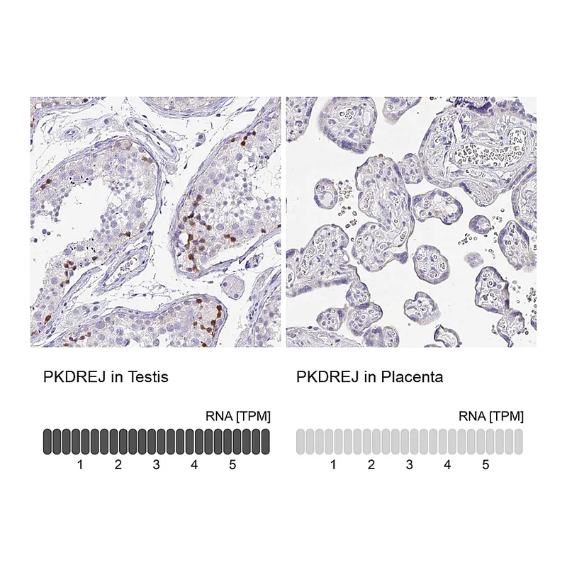 Atlas Antibodies Anti-PKDREJ Antibody