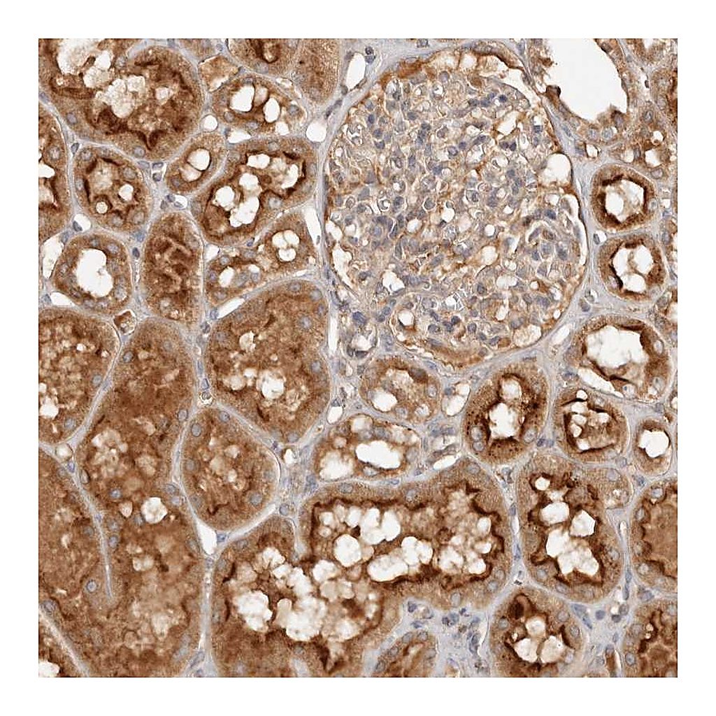 Atlas Antibodies Anti-PKIB Antibody