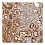 Atlas Antibodies Anti-PKIB Antibody
