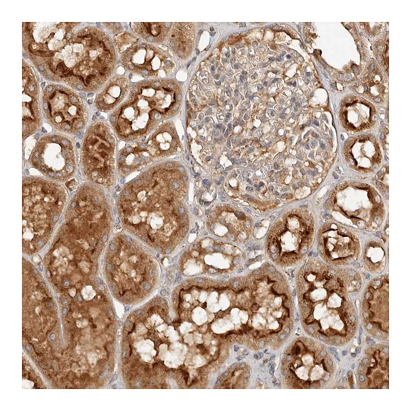 Atlas Antibodies Anti-PKIB Antibody