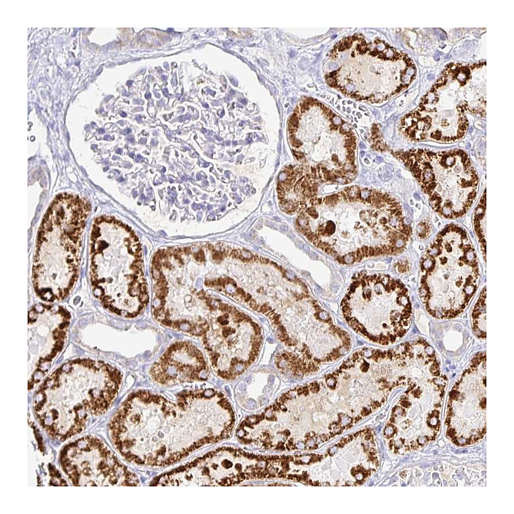 Atlas Antibodies Anti-PKHD1 Antibody