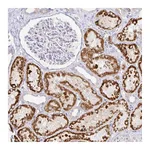 Atlas Antibodies Anti-PKHD1 Antibody