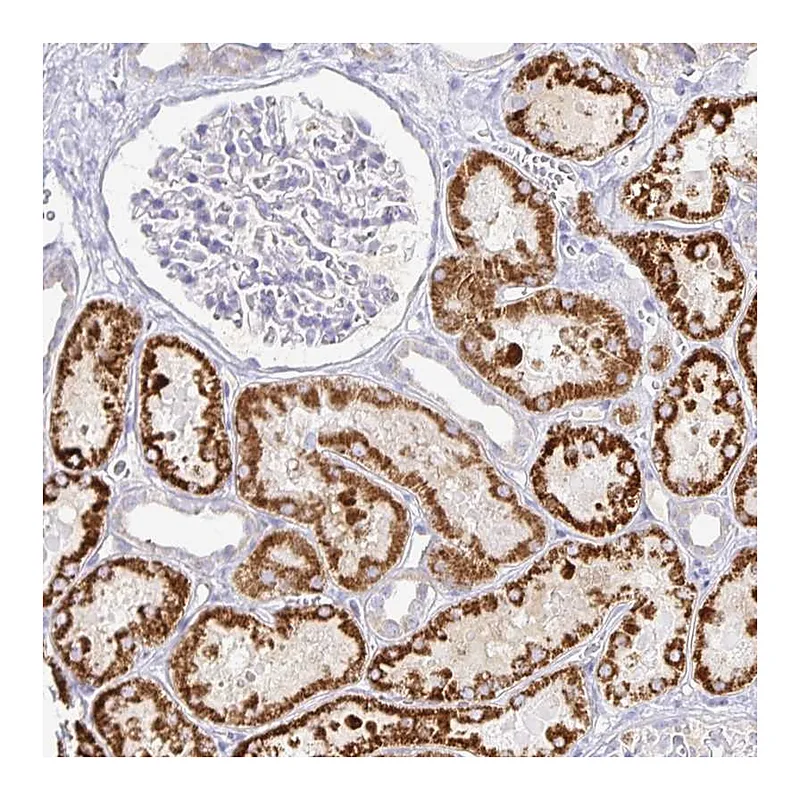 Atlas Antibodies Anti-PKHD1 Antibody