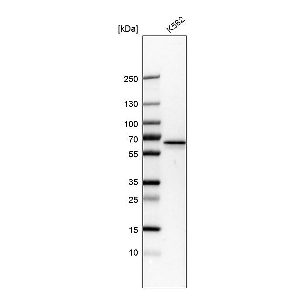 Atlas Antibodies Anti-PKLR Antibody