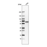 Atlas Antibodies Anti-PKLR Antibody