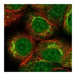 Atlas Antibodies Anti-PKMYT1 Antibody