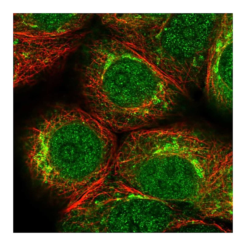 Atlas Antibodies Anti-PKMYT1 Antibody