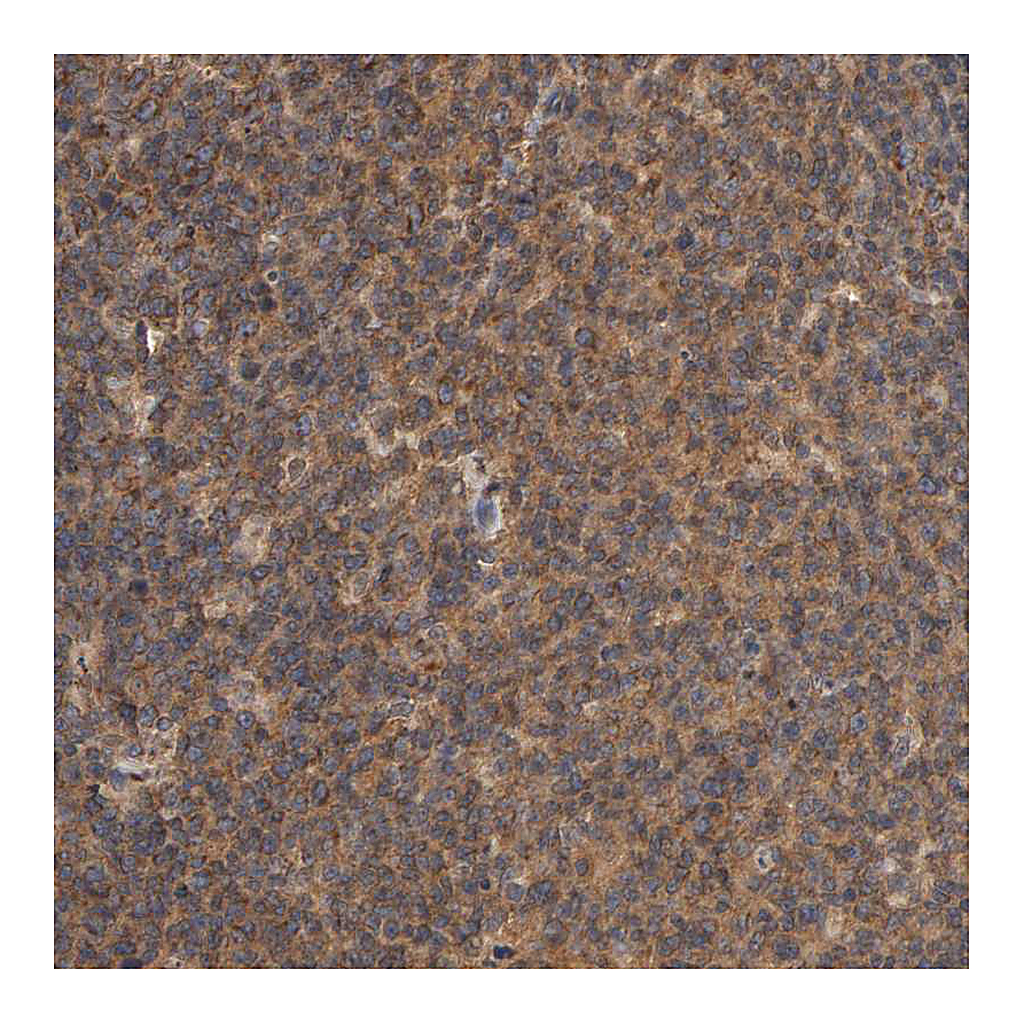 Atlas Antibodies Anti-PKN1 Antibody