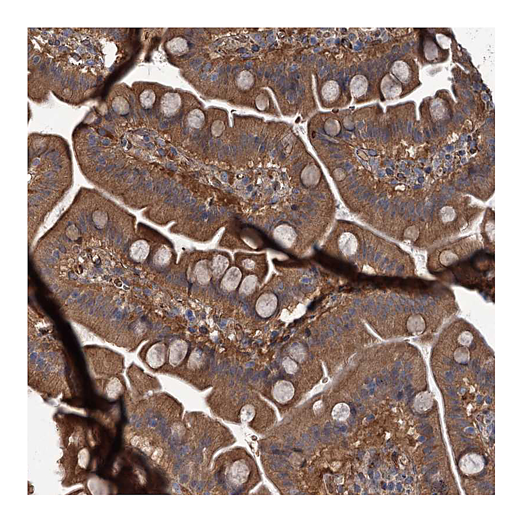 Atlas Antibodies Anti-PKN2 Antibody