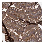 Atlas Antibodies Anti-PKN2 Antibody