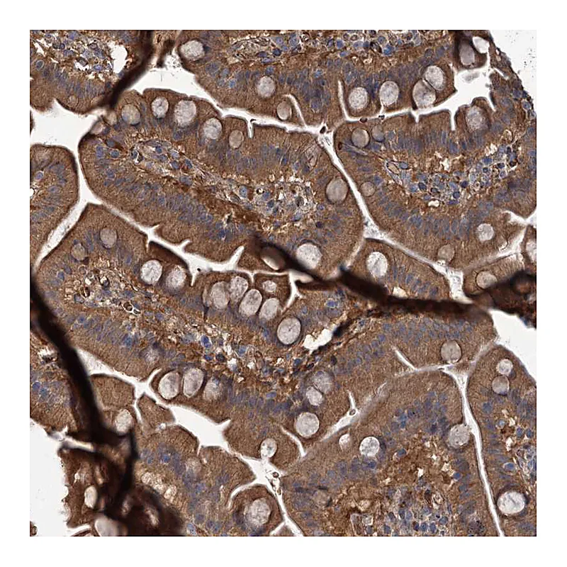 Atlas Antibodies Anti-PKN2 Antibody
