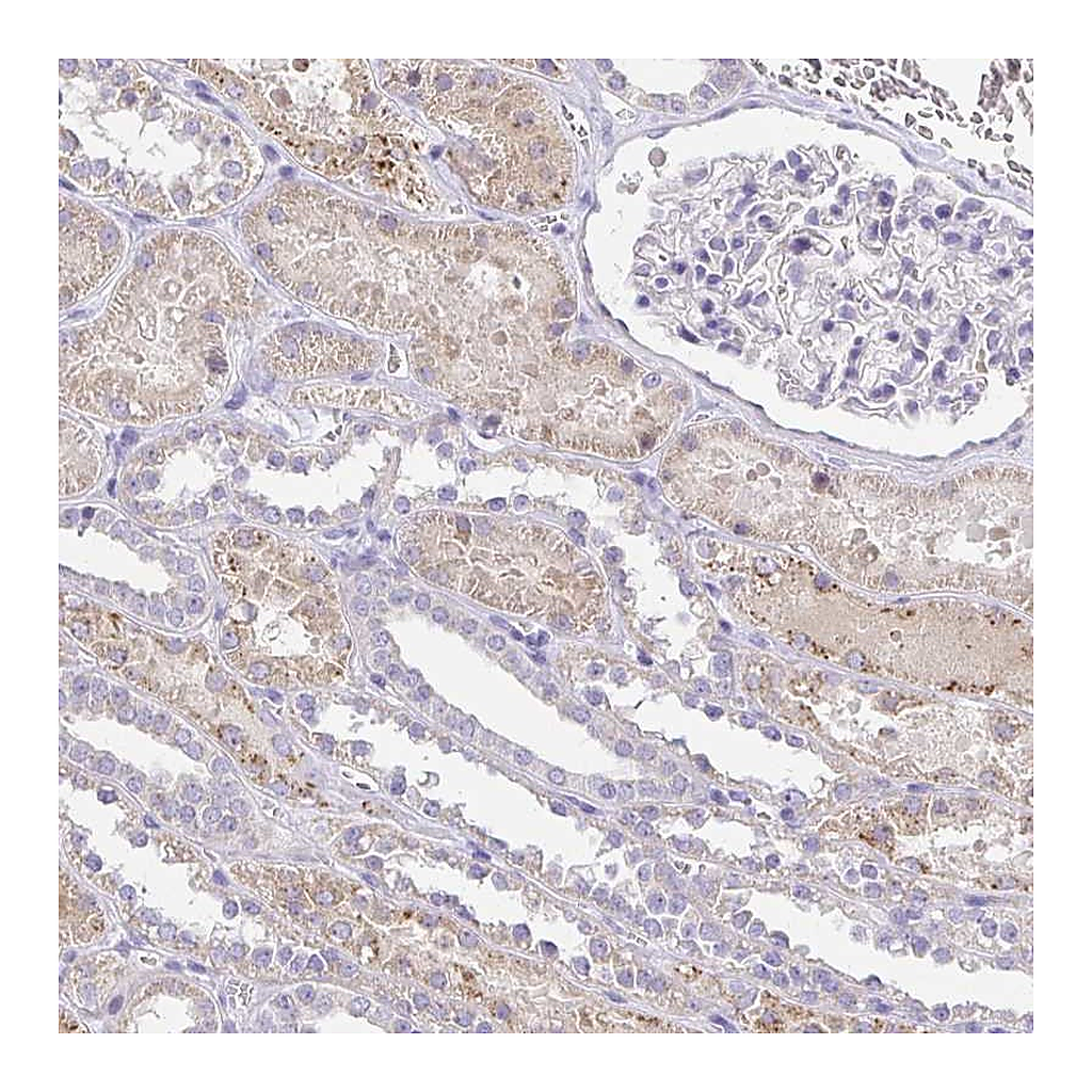 Atlas Antibodies Anti-PKN3 Antibody
