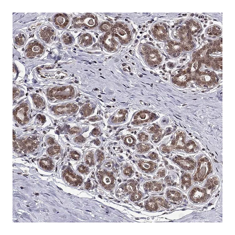 Atlas Antibodies Anti-PKN2 Antibody