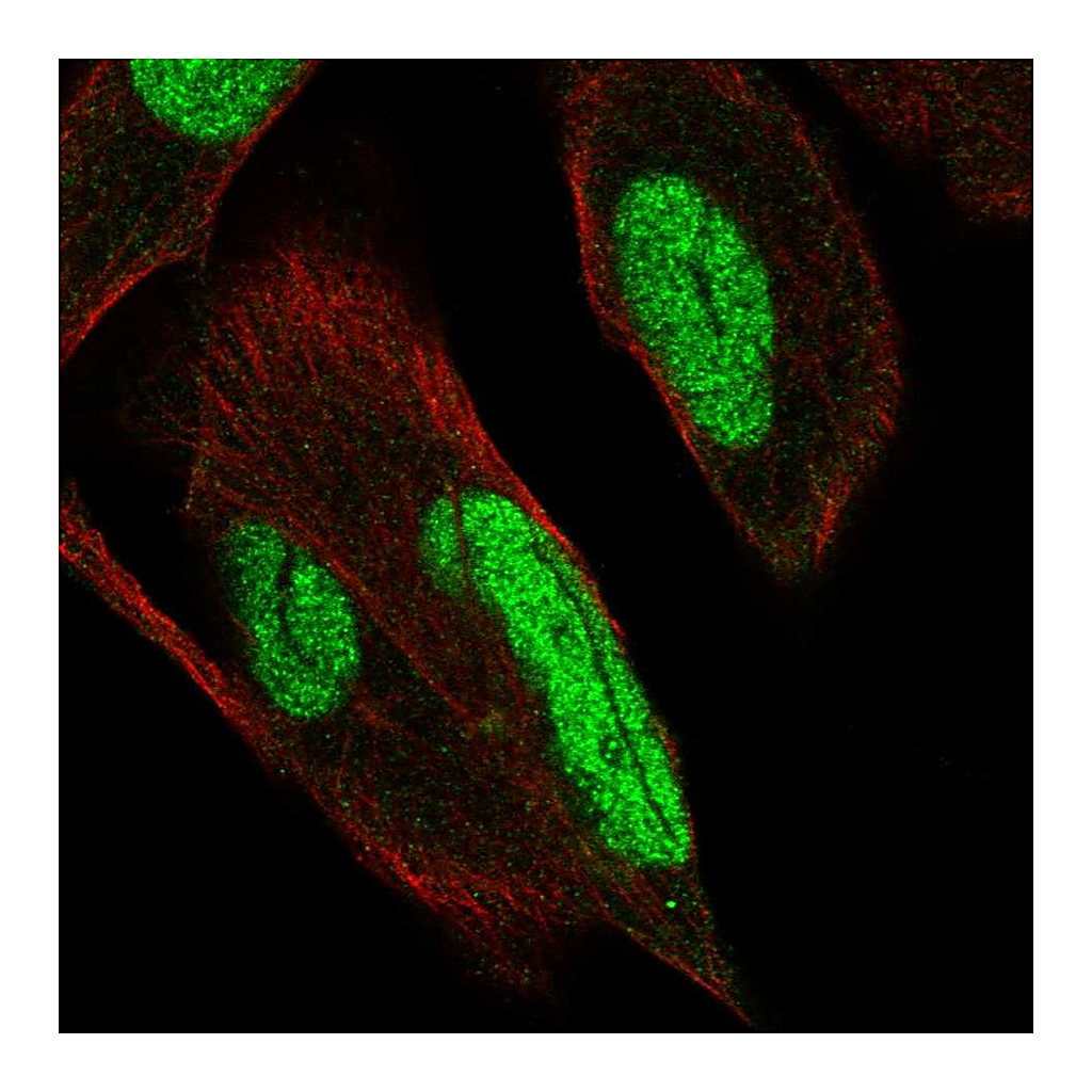 Atlas Antibodies Anti-PKNOX1 Antibody