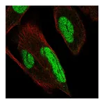 Atlas Antibodies Anti-PKNOX1 Antibody