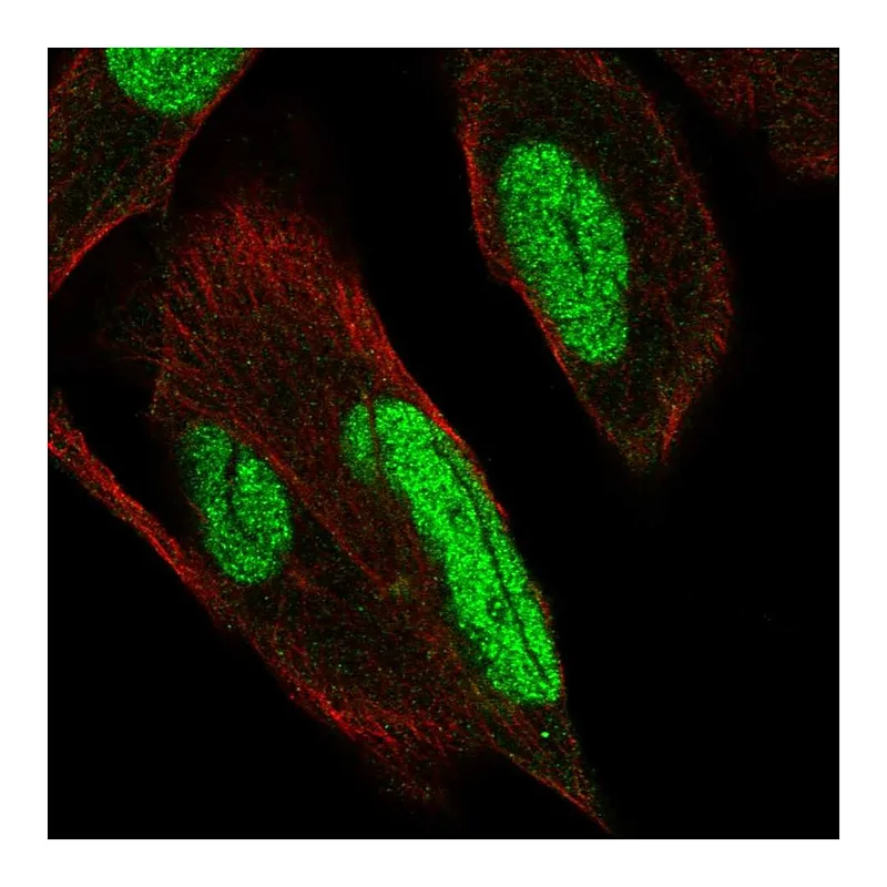 Atlas Antibodies Anti-PKNOX1 Antibody