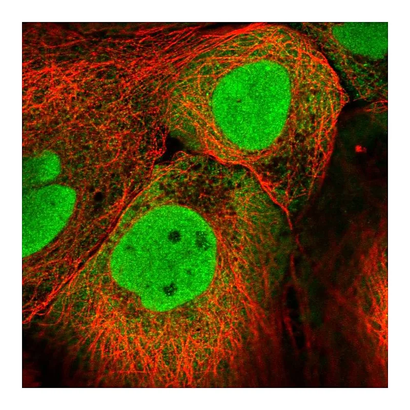 Atlas Antibodies Anti-PKNOX1 Antibody