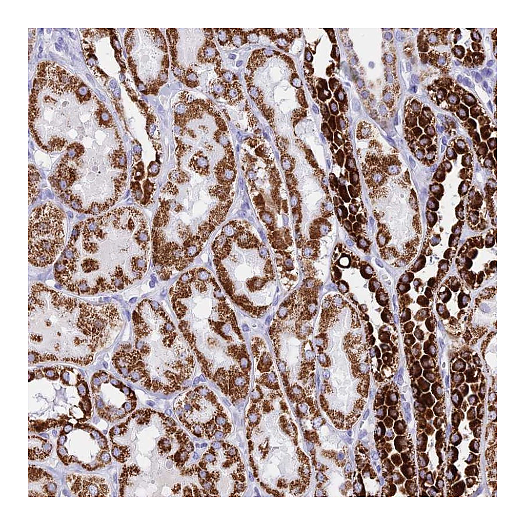 Atlas Antibodies Anti-PKN3 Antibody