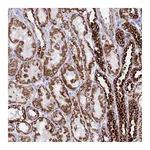 Atlas Antibodies Anti-PKN3 Antibody