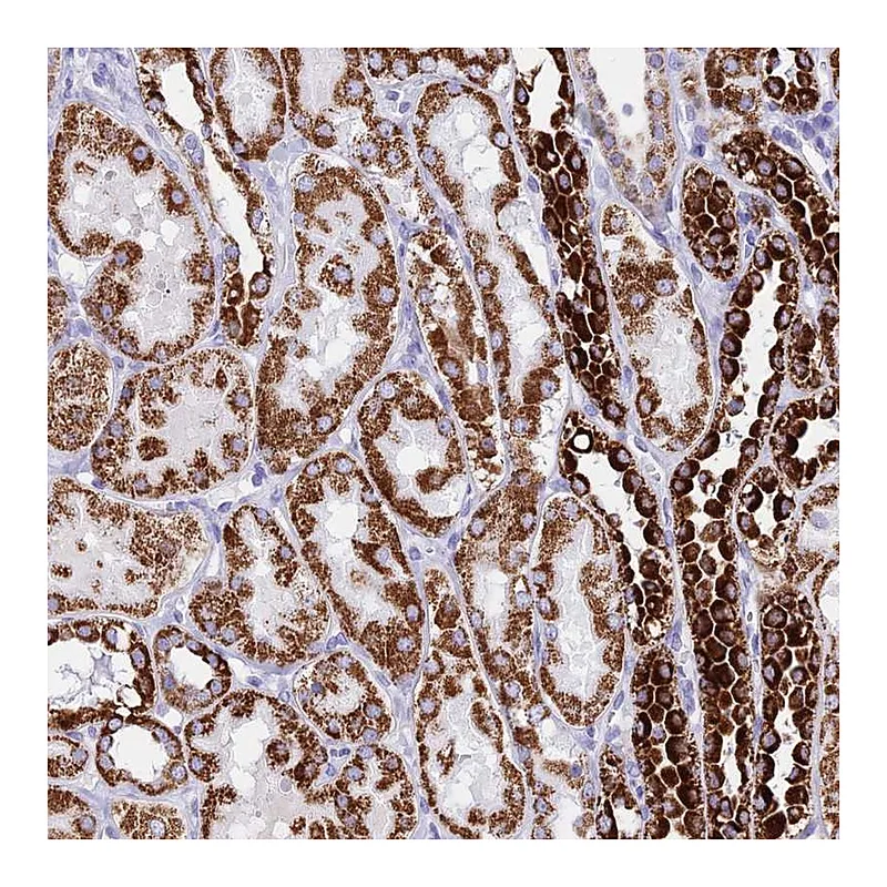 Atlas Antibodies Anti-PKN3 Antibody