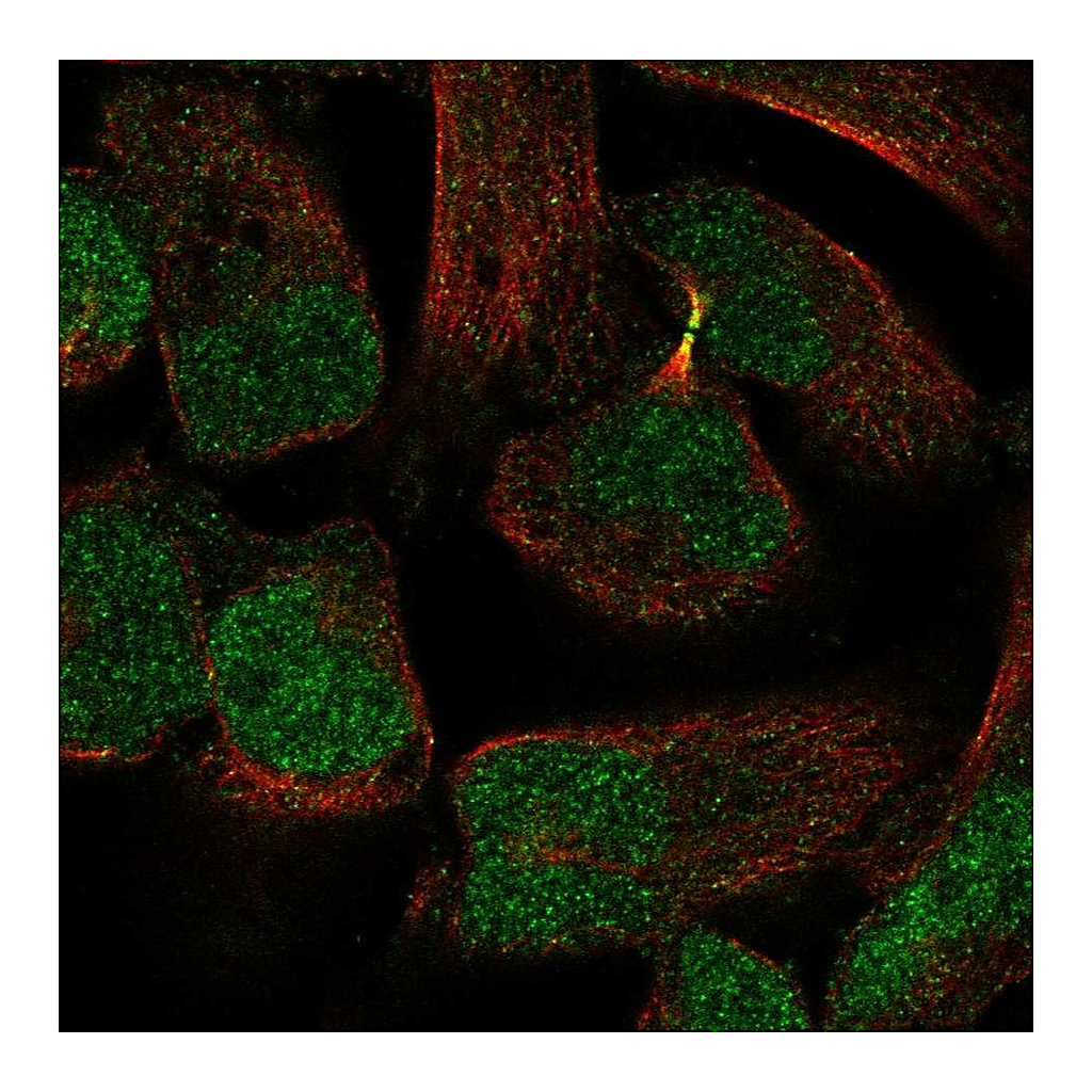 Atlas Antibodies Anti-PKNOX2 Antibody