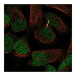 Atlas Antibodies Anti-PKNOX2 Antibody