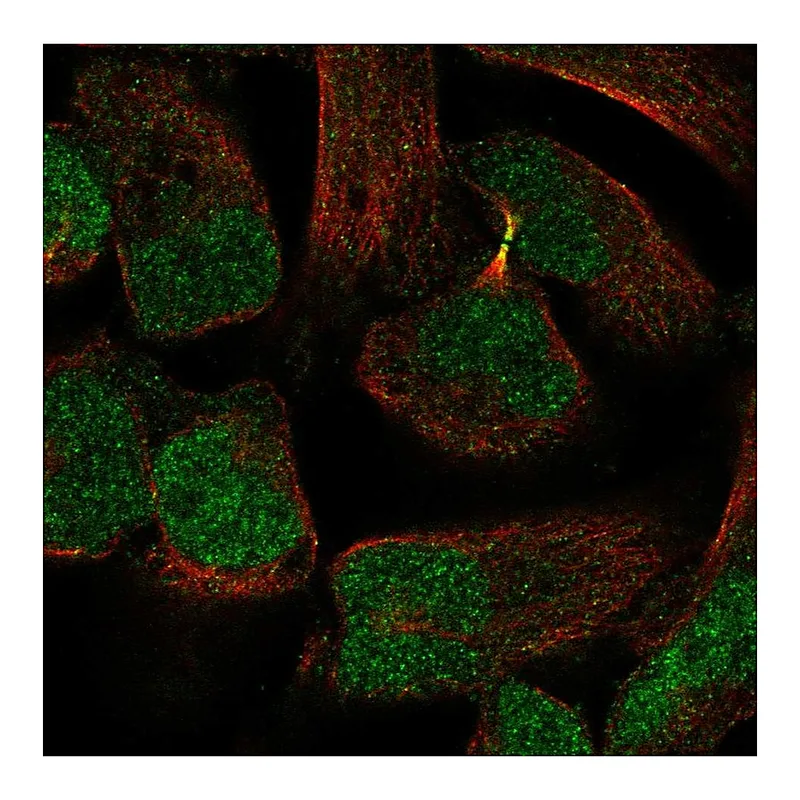 Atlas Antibodies Anti-PKNOX2 Antibody