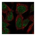Atlas Antibodies Anti-PKNOX2 Antibody