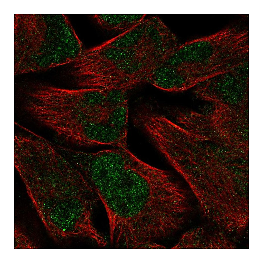 Atlas Antibodies Anti-PKNOX2 Antibody