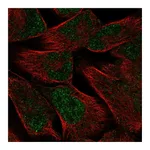 Atlas Antibodies Anti-PKNOX2 Antibody