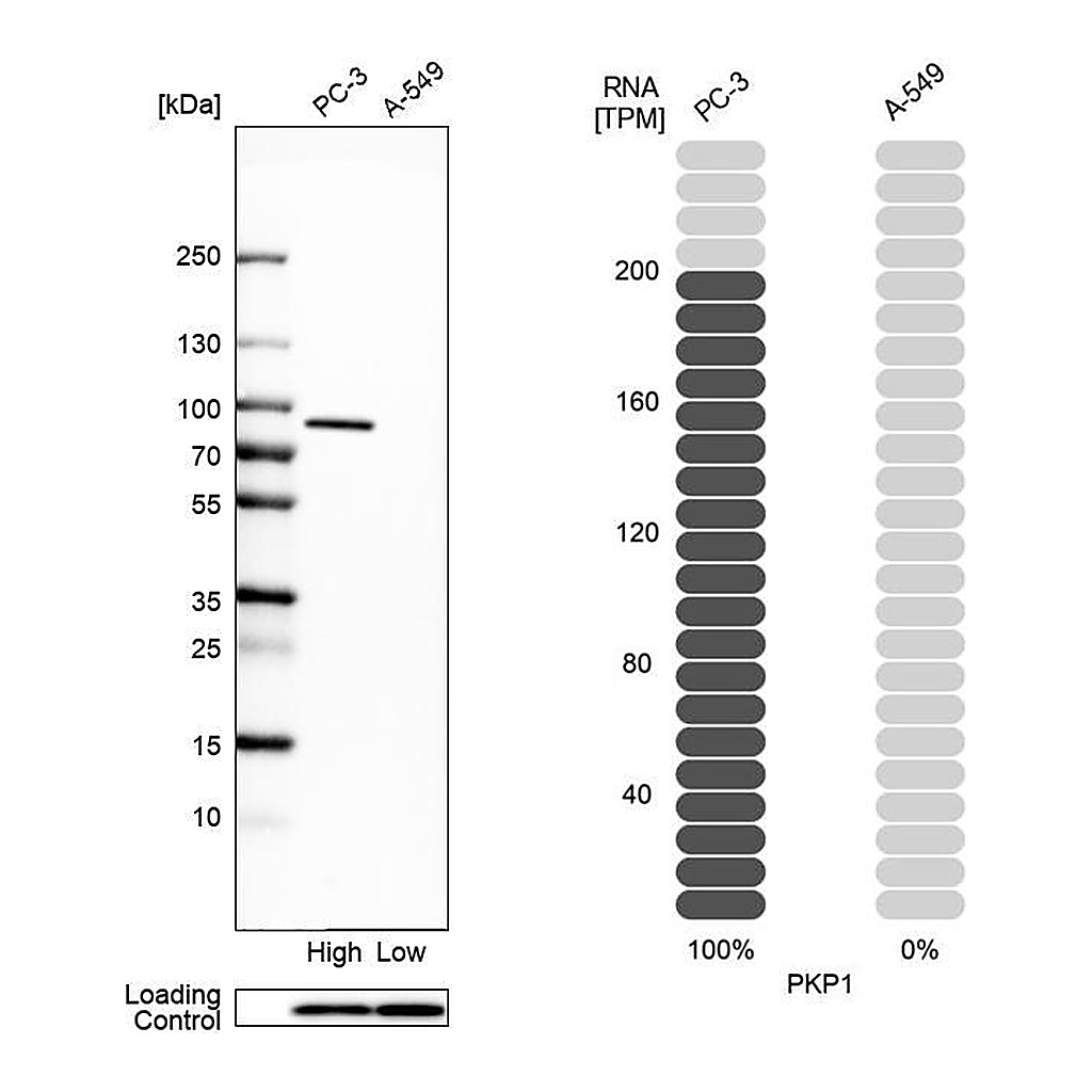 Atlas Antibodies Anti-PKP1 Antibody