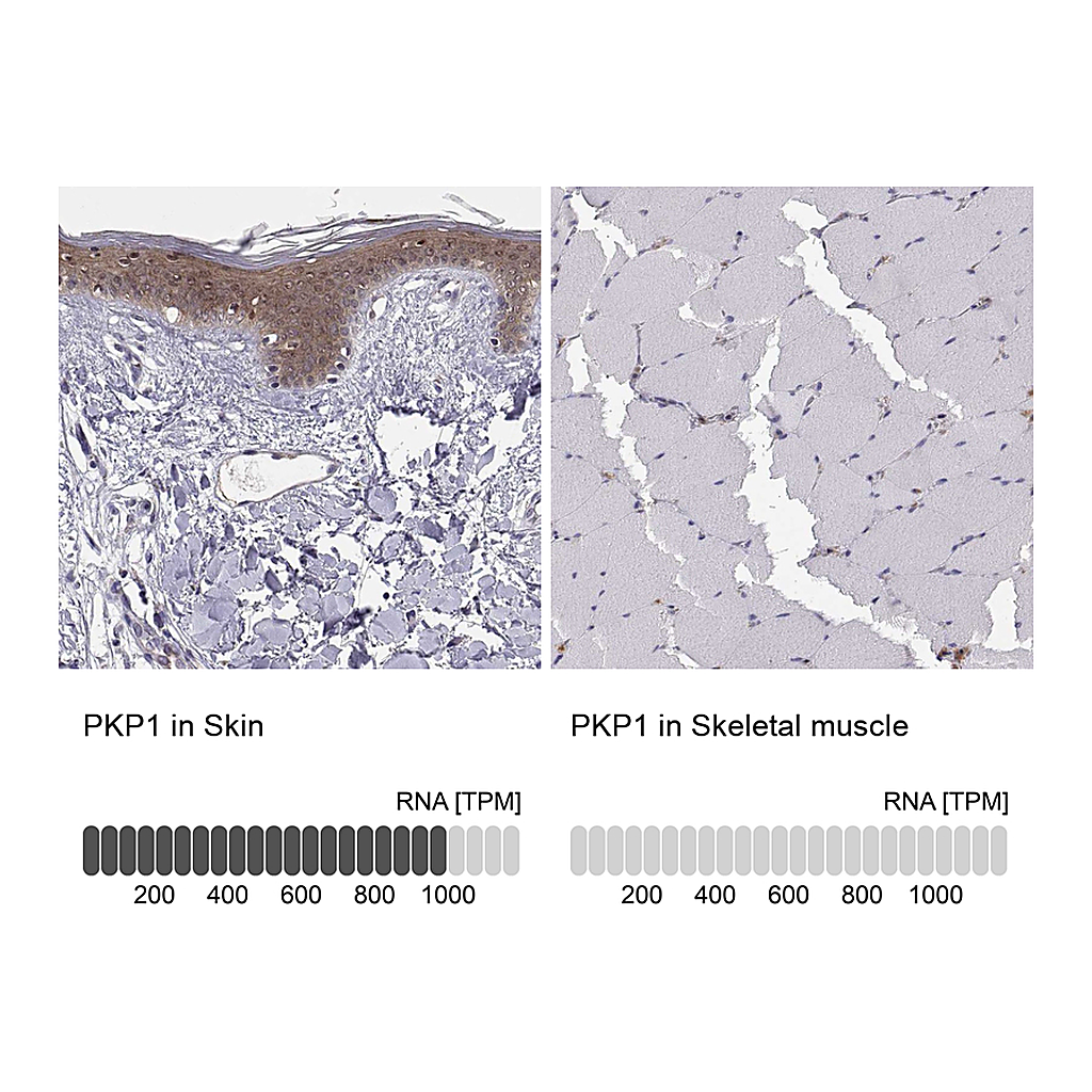 Atlas Antibodies Anti-PKP1 Antibody