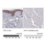 Atlas Antibodies Anti-PKP1 Antibody