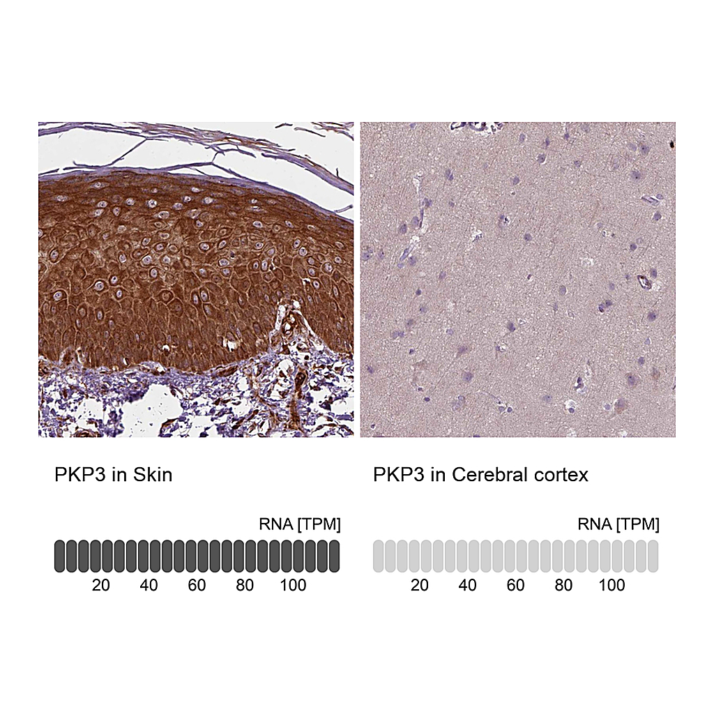 Atlas Antibodies Anti-PKP3 Antibody