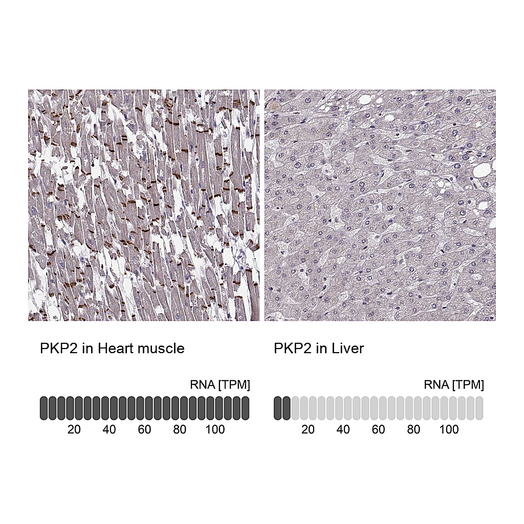 Atlas Antibodies Anti-PKP2 Antibody