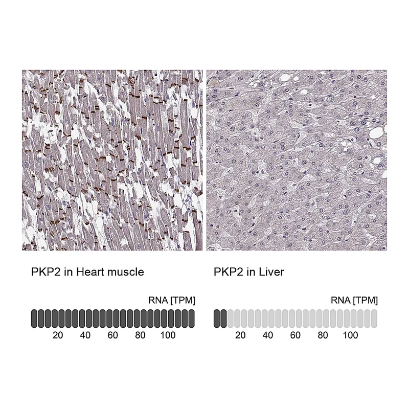 Atlas Antibodies Anti-PKP2 Antibody