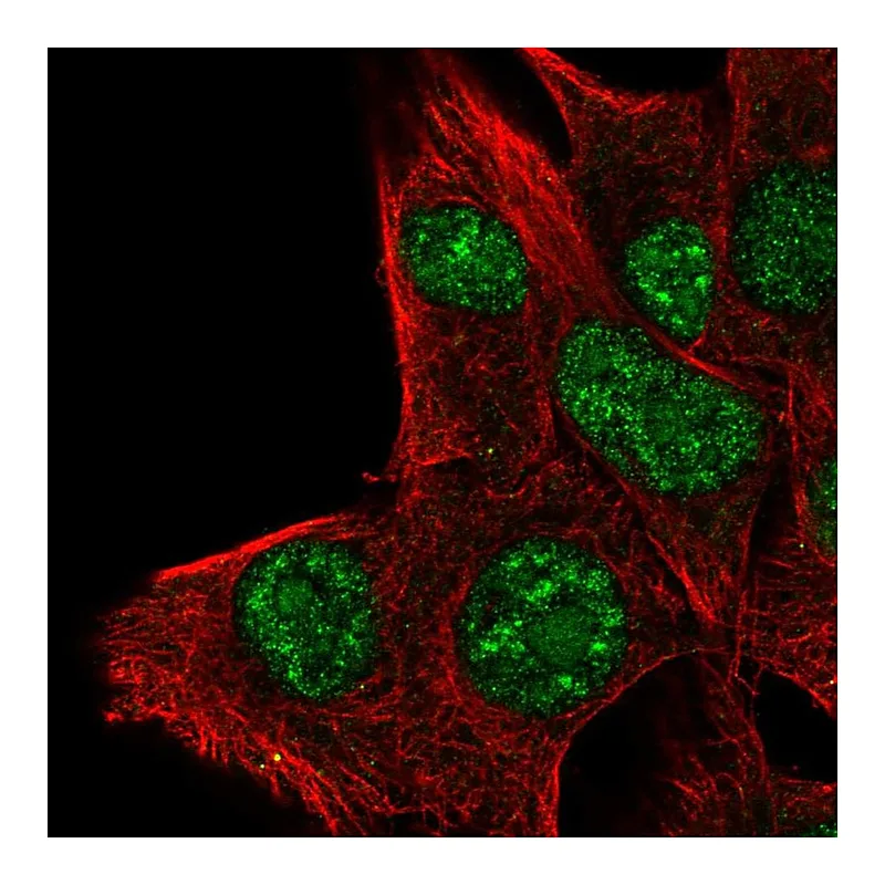 Atlas Antibodies Anti-PLA1A Antibody