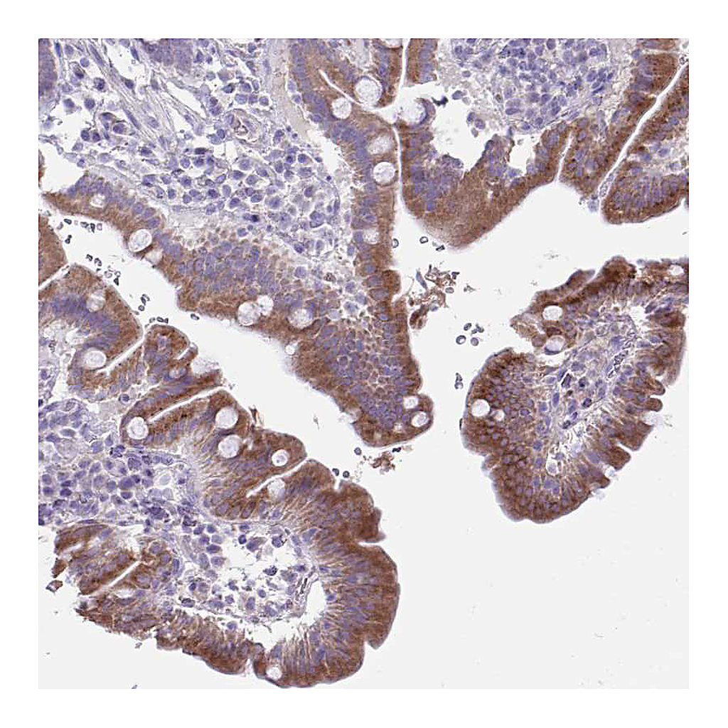 Atlas Antibodies Anti-PLA2G12B Antibody