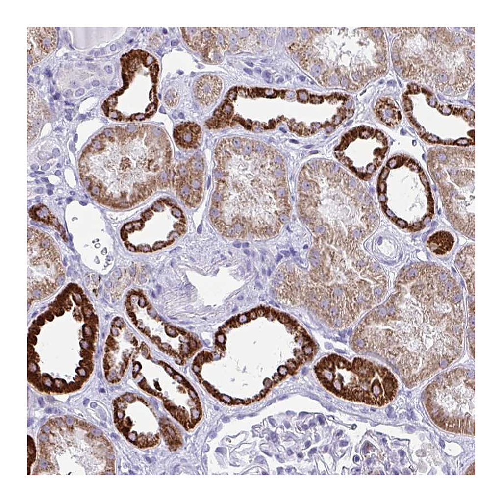 Atlas Antibodies Anti-PLA2G12B Antibody