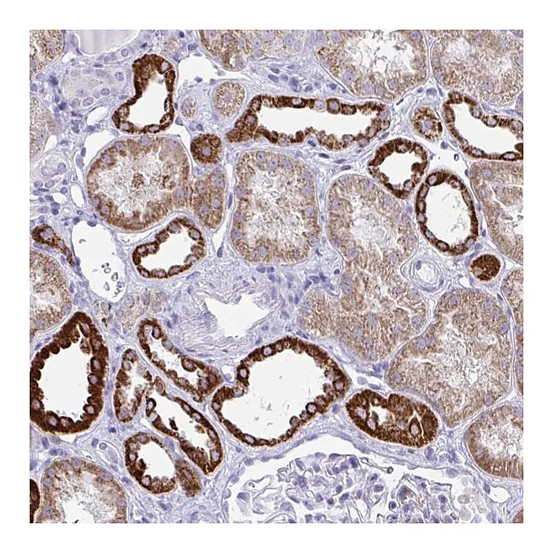 Atlas Antibodies Anti-PLA2G12B Antibody