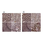 Atlas Antibodies Anti-PLA2G15 Antibody