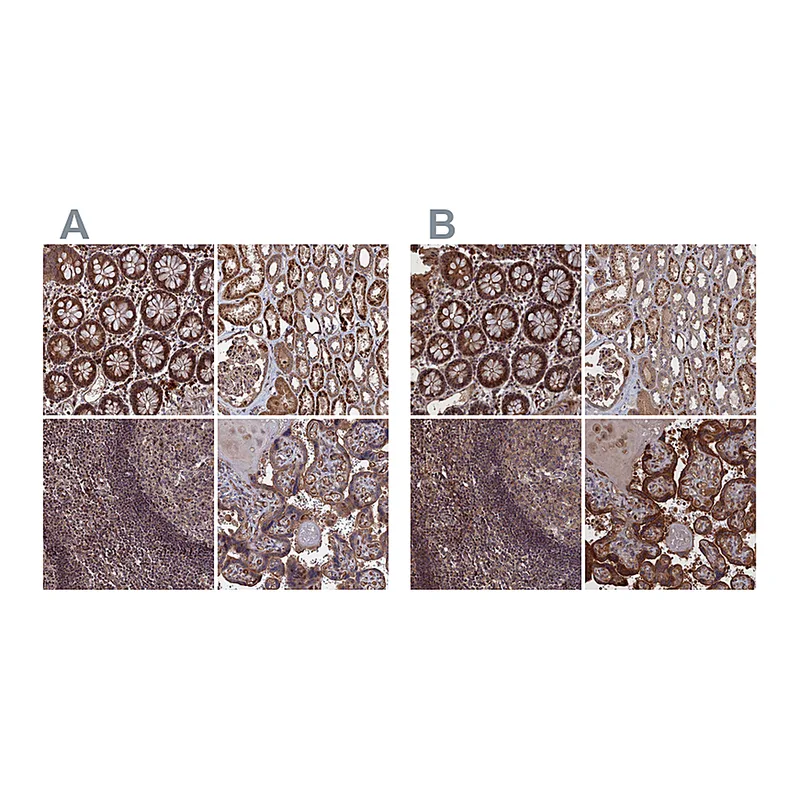 Atlas Antibodies Anti-PLA2G15 Antibody