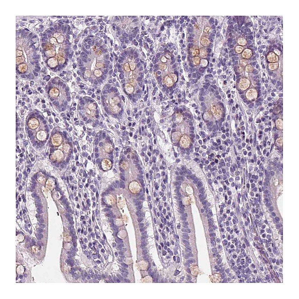 Atlas Antibodies Anti-PLA2G2E Antibody