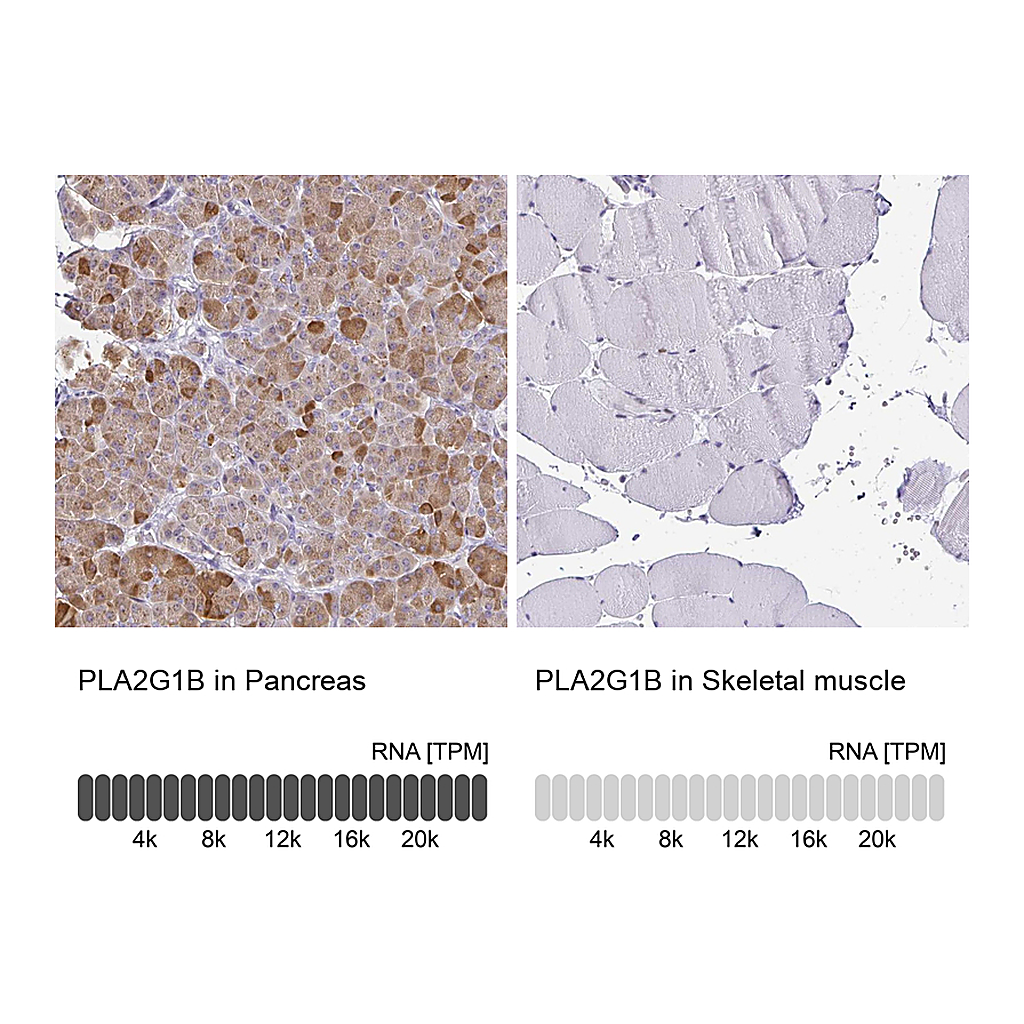 Atlas Antibodies Anti-PLA2G1B Antibody