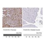 Atlas Antibodies Anti-PLA2G1B Antibody
