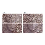 Atlas Antibodies Anti-PLA2G15 Antibody