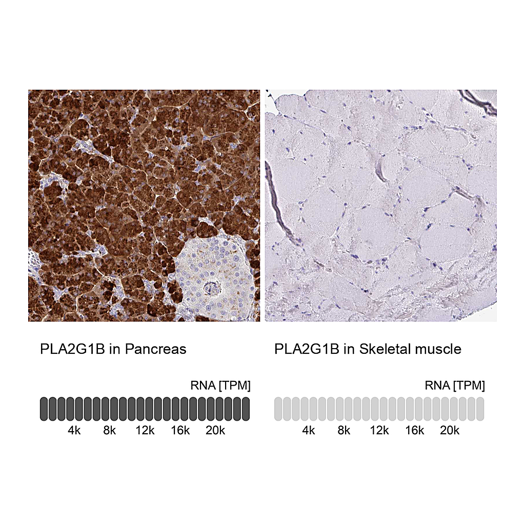 Atlas Antibodies Anti-PLA2G1B Antibody